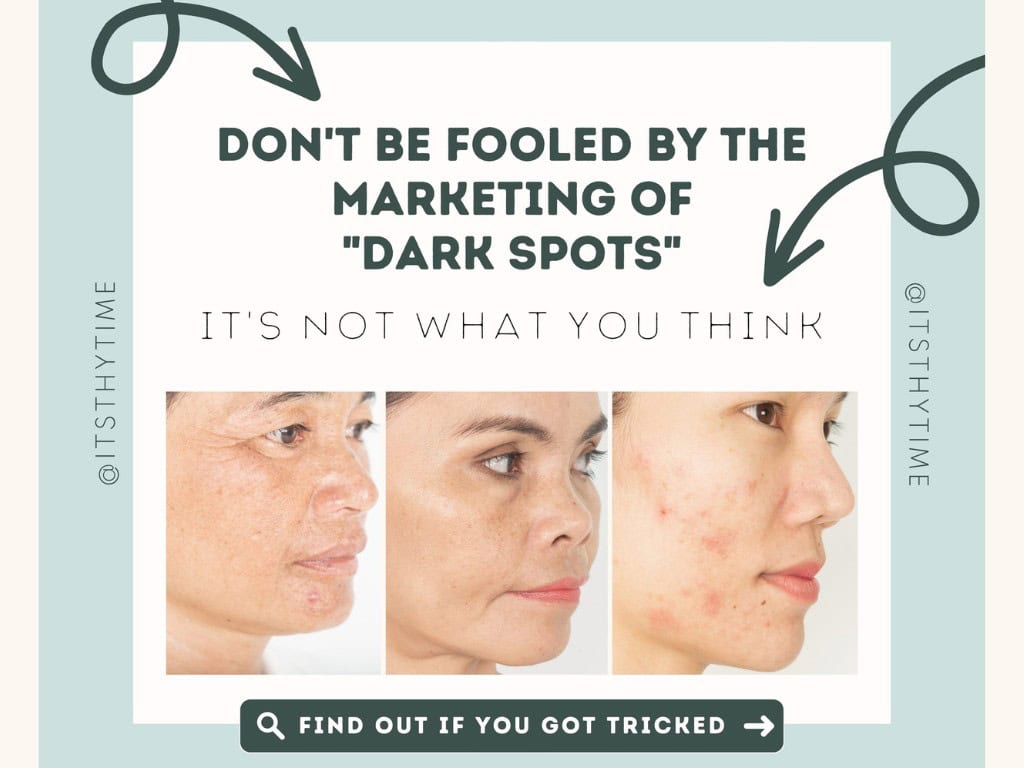 Why Your Dark Spots Aren’t Lightening, And What to do Instead