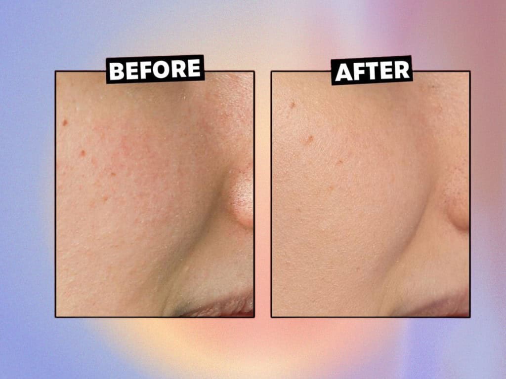 Gentle AHA Toners Might be The New Standard For Exfoliating