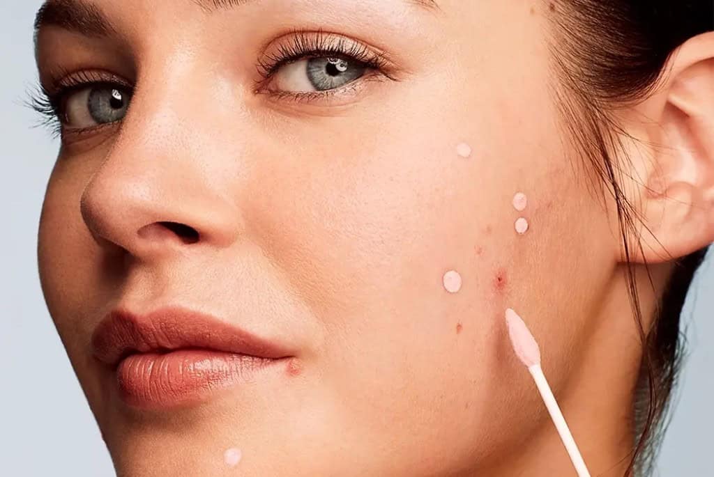 Underrated Ingredients in Skincare: Sulfur