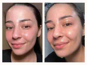 Close-up image of a woman showing skin improvement with skincare.