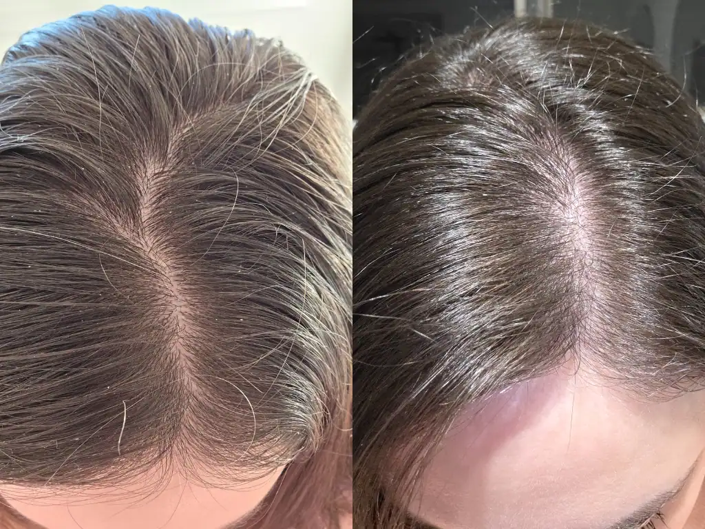 The Very Unconventional Method I Use to Detox My Sensitive Scalp
