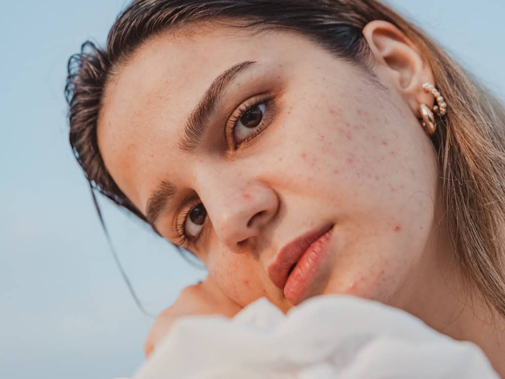 My Tretinoin Journey: Why I Started, My Results, Side Effects, and How I Use it in My Skincare Routine