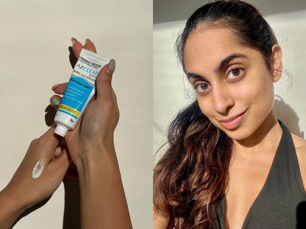 AzClear azelaic acid medicated lotion for acne scarring