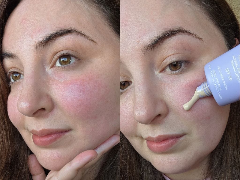 How sunscreen protects and supports the skin barrier