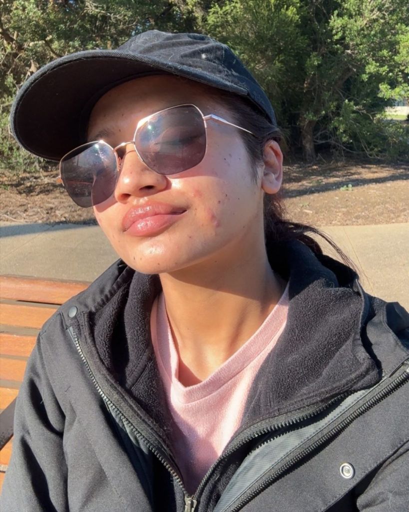 Mamata Thapa feeling confident with adult acne outdoors